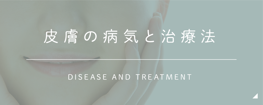 皮膚の病気と治療法 DISEASE AND TREATMENT